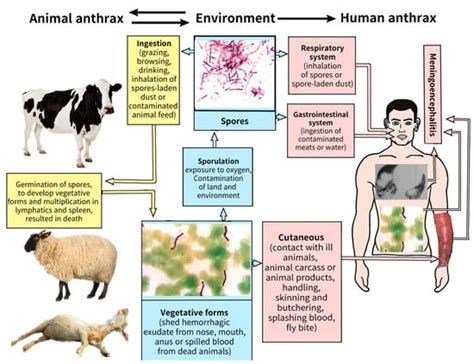 Diagnostics | Free Full-Text | Human Anthrax: Update of the Diagnosis ...