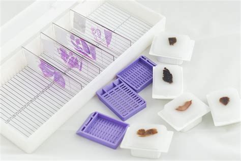 ᐉ FFPE Tissue Samples for Research | Purchase FFPE Blocks ᐉ Human FFPE ...