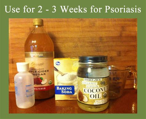 Homemade Natural Psoriasis Shampoo - RemedyGrove