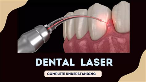 Dental laser: Types, parameter, Indication, advantage and dental laser ...