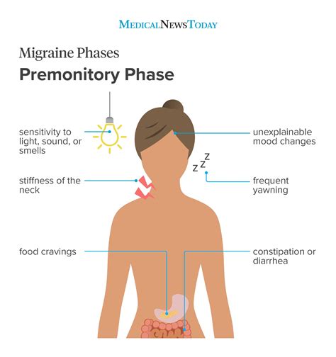 Ocular migraine: Everything you need to know - Medical Finest