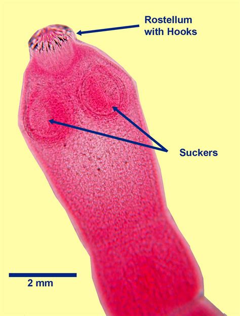 Echinococcus Granulosus Scolex