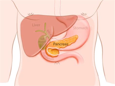 Pancreas Basics - Pancreatic Cancer | Johns Hopkins Pathology