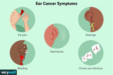 Ear Cancer: Types, Causes, and Treatments