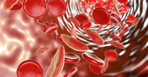 Sickle Cell Anemia: Types, Causes, Symptoms, Diagnosis & Treatment