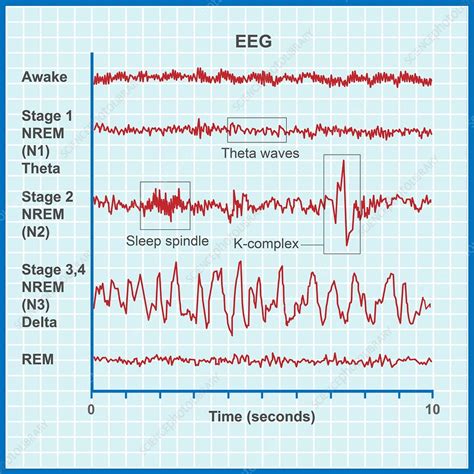 EEG sleep stages, illustration - Stock Image - C051/0064 - Science ...