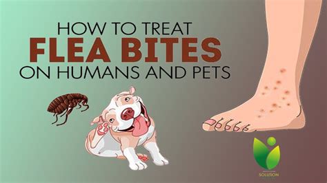 How to Treat Flea Bites on Humans and Pets ~ Home Remedies For Flea ...