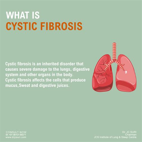 Cystic Fibrosis (CF): Symptoms, Causes, Diagnosis & Treatment