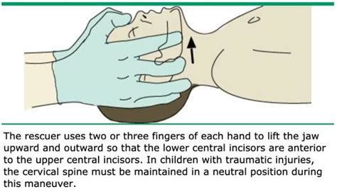 Jaw Thrust maneuver. | Download Scientific Diagram