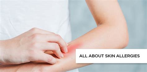 Skin Allergy: Types, Causes, and Symptoms | Max Lab