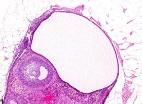 Ovary, Follicle - Cyst - Nonneoplastic Lesion Atlas