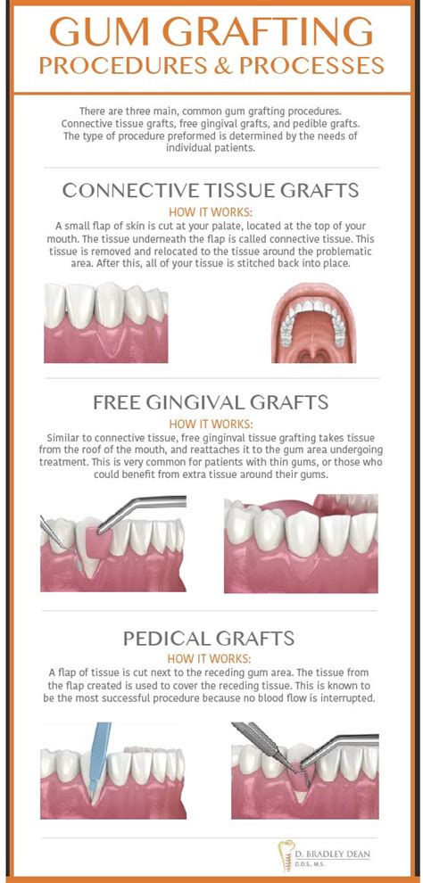 Periodontal Surgery Plano TX | Gum Disease Treatment