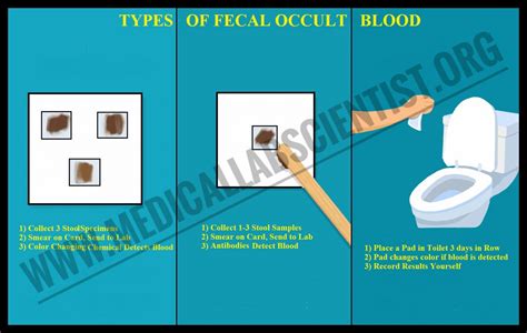 Faecal Occult Blood Tests (FOBTs) : Significance, Methods ...