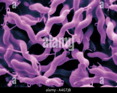 CAMPYLOBACTER JEJUNI Stock Photo, Royalty Free Image: 53847555 - Alamy