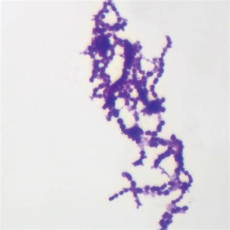 Streptococcus Pyogenes Gram Stain