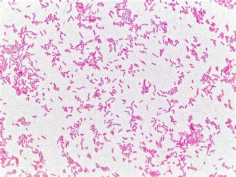 Gram Stain And Capsule Stain