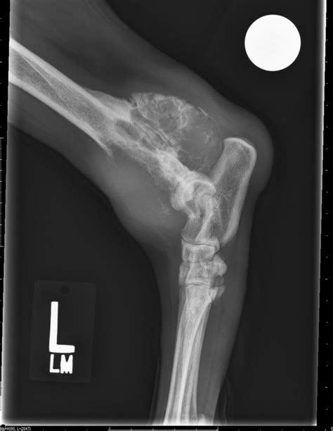 Osteosarcoma Symptoms