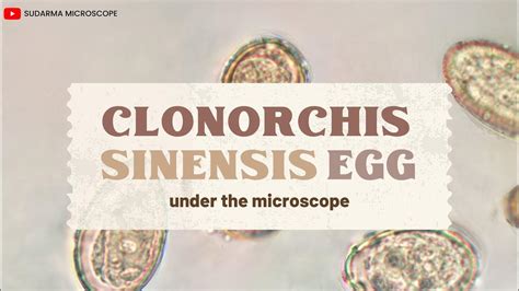 Clonorchis sinensis egg under the microscope - YouTube