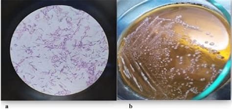 Morphological and microscopic properties of Lactobacillus bulgaricus ...