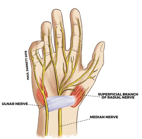 Hand & Wrist Anatomy - Dr Paul Jarrett, Hand, Wrist & Shoulder Surgeon.