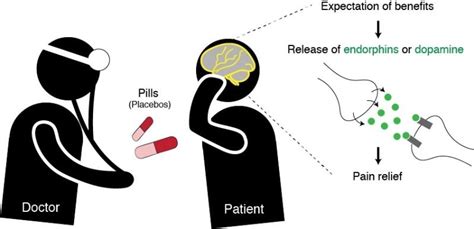 8 Placebo Effect Examples in Real Life – StudiousGuy