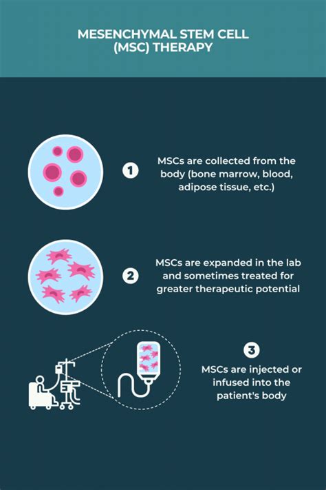 Stem cell therapy and MS | Multiple Sclerosis News Today