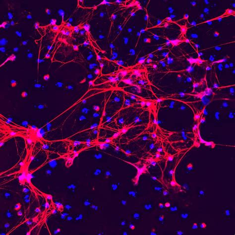 Neutrophil Extracellular Traps (NETs) Fighting Microbes