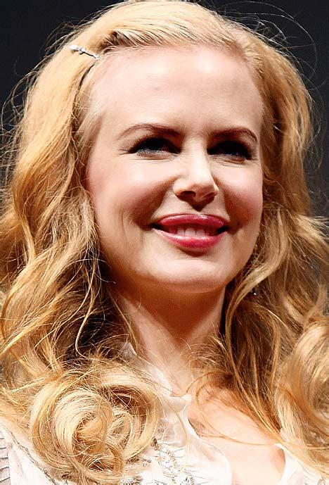 Botox is turning Nicole Kidman into a 'bat face', says cosmetic guru ...