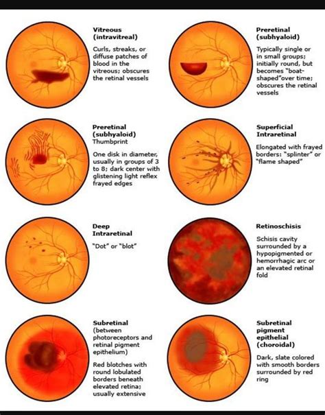 Pin em Physiology and medicine