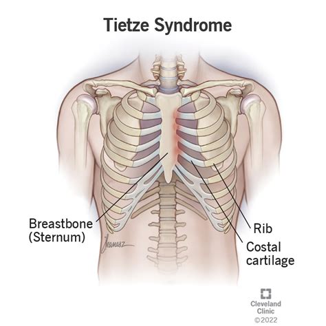 Sternum Location