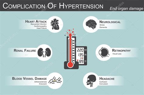 Complicación de la hipertensión (ataque al corazón: infarto de ...