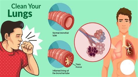 Constant Mucus In Throat