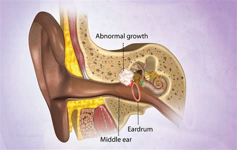 Health Condition : Symptoms, Causes, Treatment and More