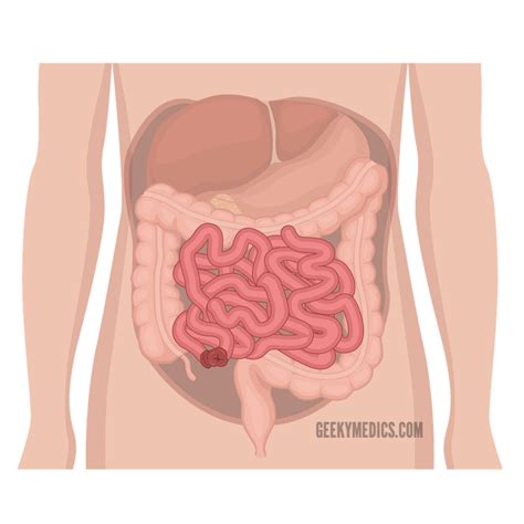 Stoma Examination - OSCE Guide | Geeky Medics