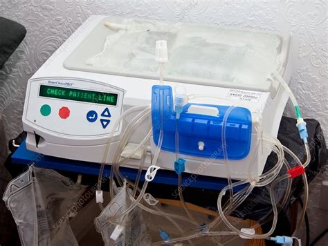 Dialysis Machine Home Gambro phoenix machine dialysis unit nice