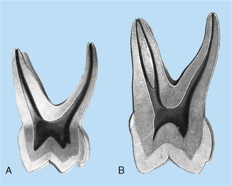 16: Deciduous Dentition | Pocket Dentistry