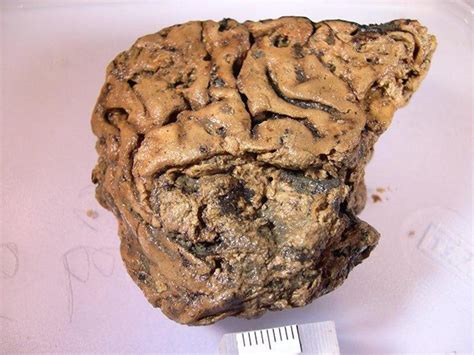 This human brain tissue survived intact for 2,600 years, and we may ...