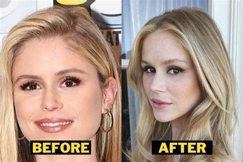 Has Erin Moriarty Undergone Plastic Surgery? Before After Photos