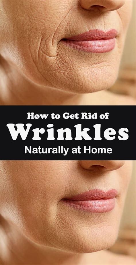 How to get rid of wrinkles naturally at home | Home remedies for ...