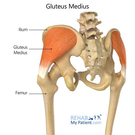 IM Injection Gluteus Medius