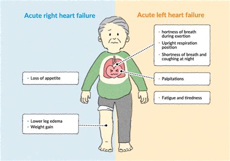 Congestive Heart Failure Symptoms