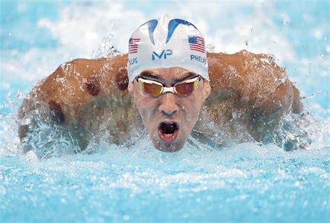 Michael Phelps' cupping therapy draws Olympic attention | Modern Healthcare