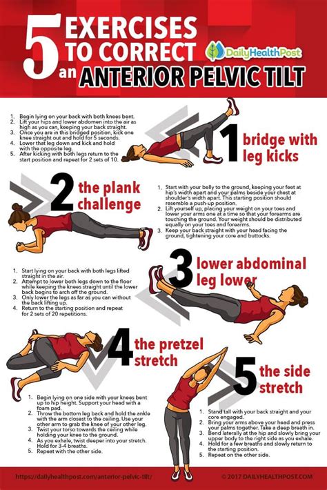 5 Exercises to Correct an Anterior Pelvic Tilt to Get Rid of Hip ...