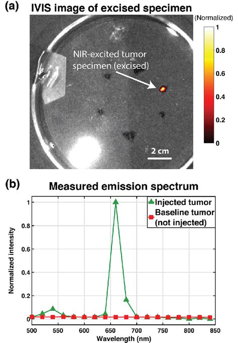 Excised prostate tumor imaging results with IVIS spectrum imager: a ...