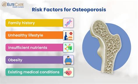 A Complete Guide to Managing Osteoporosis in Seniors | EliteCare