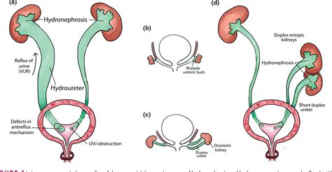 Figure 4 from Lower urinary tract development and disease. | Semantic ...