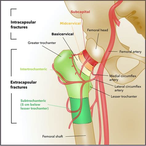 Bony And Vascular Anatomy Of The Proximal Femur Adapted From | The Best ...