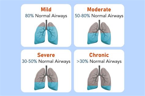 Stages Of Copd Chart