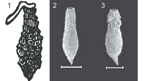 Specimens of Difflugia protaeiformis Lamark, 1816, the type species of ...