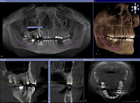 Dr. Bob's Tooth Truth Blog - Robert Schwan D.M.D